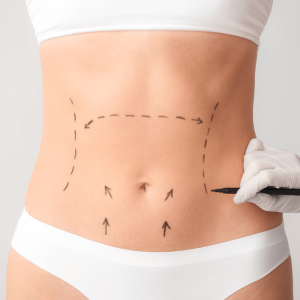 Body Recon Clinic Geelong - Plastic and Reconstructive Surgery